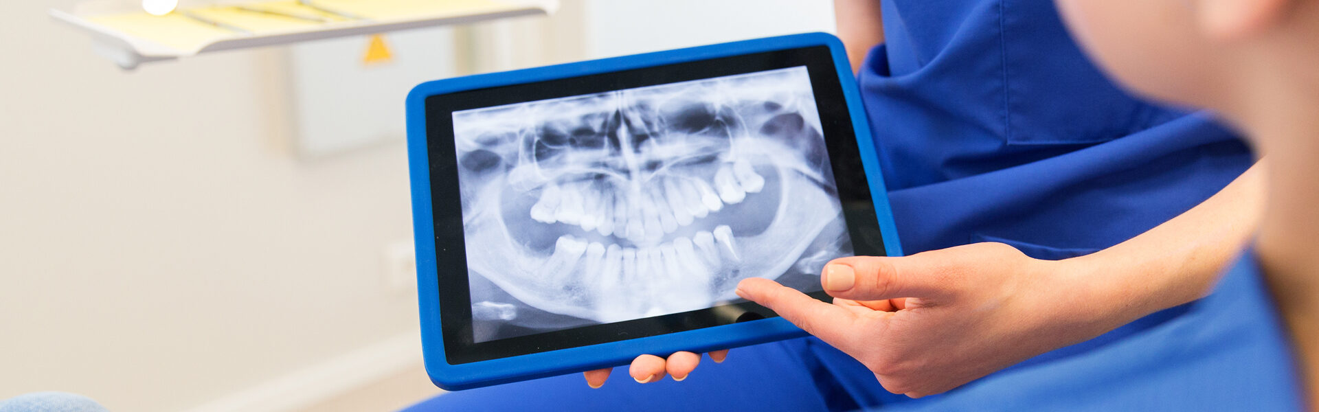 Digital-X-Rays
