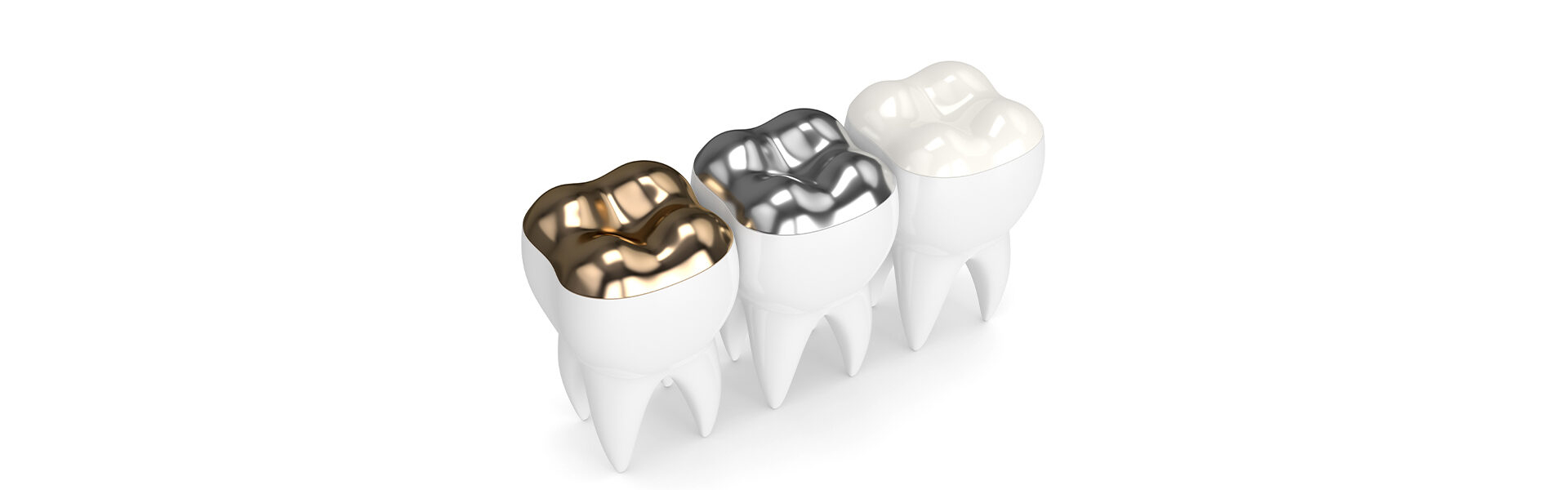 Aesthetic Stainless Steel Crowns: Durable and Reliable Solutions in Crosby, TX