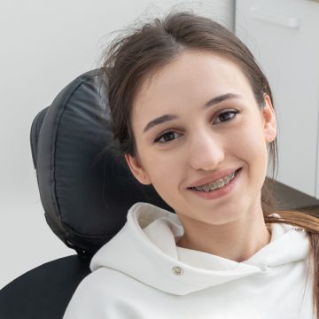 How to Choose the Right Dental Braces for Your Smile?